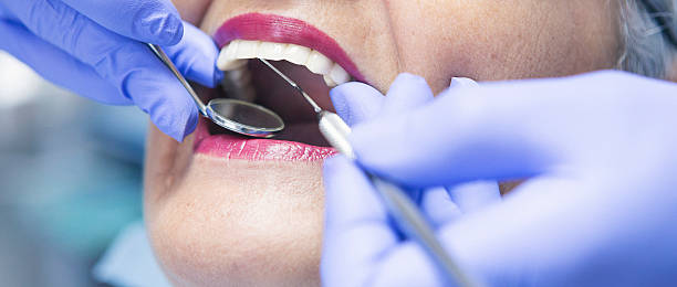 Best Emergency Root Canal Therapy in Springerville, AZ